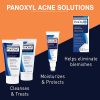 PanOxyl Acné Espuma de lavado Peróxido de benzoilo 10% Fuerza máxima antimicrobiano, 5.5 oz - Imagen 6