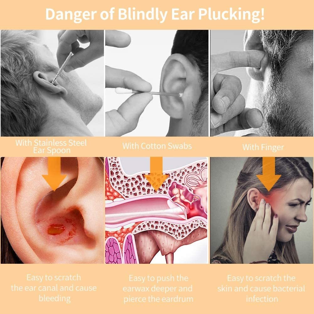 La Eliminación De Cera Del Oído Del Endoscopio, Limpiador De