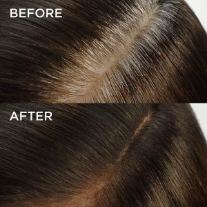 Loreal Paris Magia Raíz De Rescate 10 Radiculares De Colore