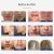 Unoisetion Máquina Facial De Alta Frecuencia Con Neón, Portá