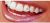Belle G Diente De Cristal Kit – 20 Piezas Cristales Claros