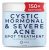 Ayadara Cystic, Hormonal Severe Acne Spot Treatment | Natu