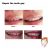 Dientes Temporales De Reparación De Dientes Rellenos De Repu